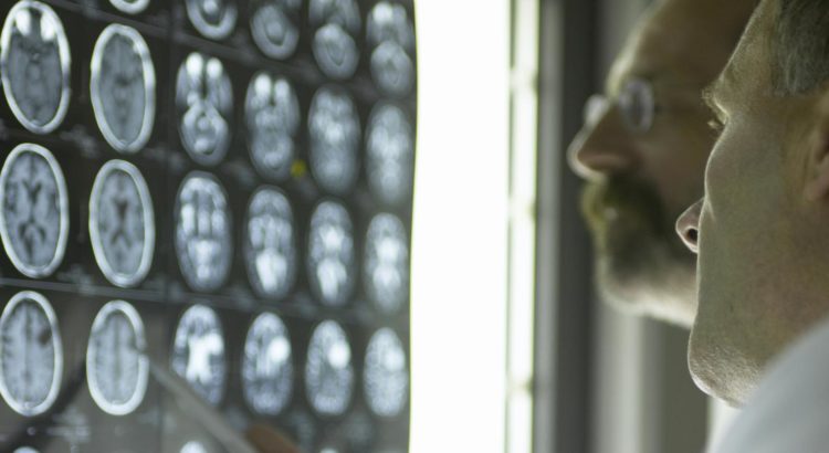 Doctors look at brain scans of a patient