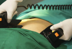 Doctor using a defibrillator at hospital